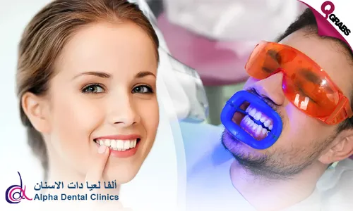 Fläsh Teeth Whitening at Alpha Dental Clinics!